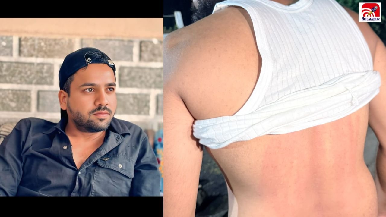 Bilaspur News: सरकंडा में हिस्ट्रीशीटर की दबंगई! पैसे देने से इनकार पर बस एजेंटों से मारपीट, केस दर्ज